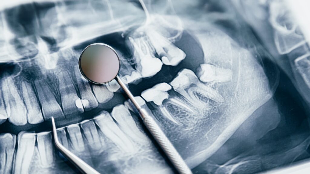 A dental X-ray.