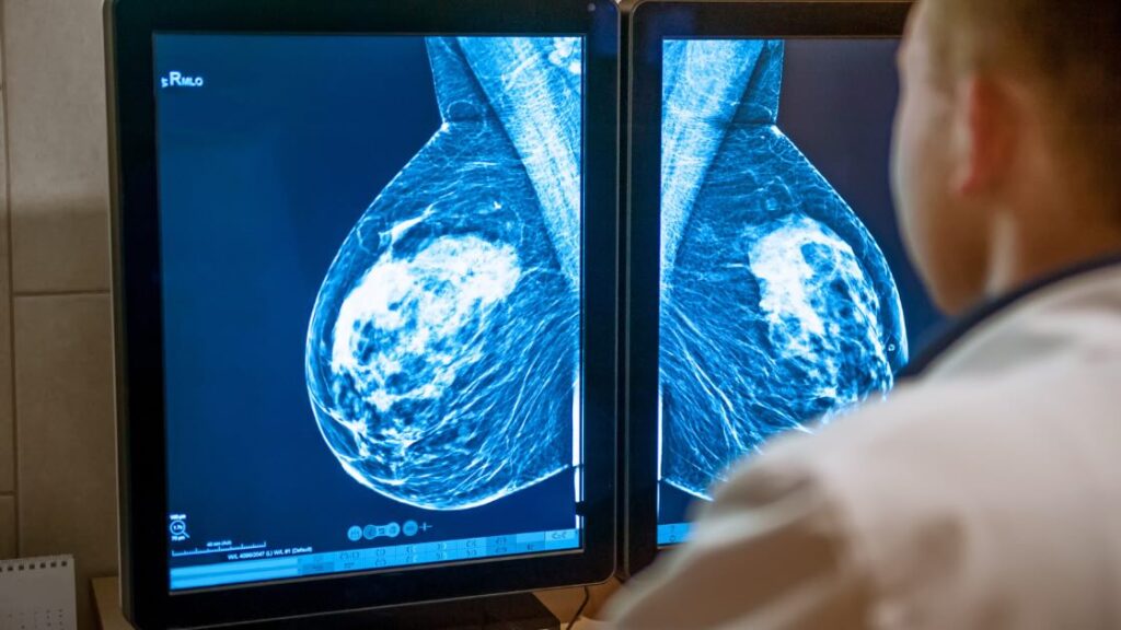 A doctor reviews two mammograms on computer screens.