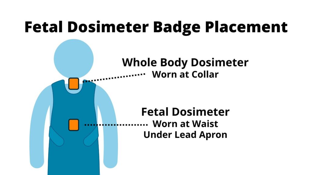 Fetal dosimeter badge placement guide: whole body dosimeter worn at the collar, fetal dosimeter worn at the waist.